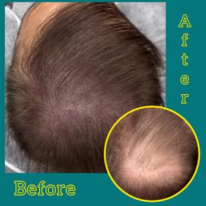 میکرواسکالپ ژیکو