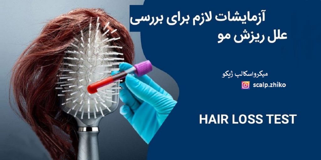 آزمایش های مورد نیاز برای ریزش مو
