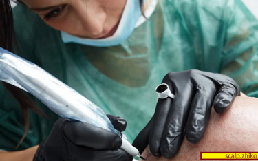 میکرواسکالپ چیست