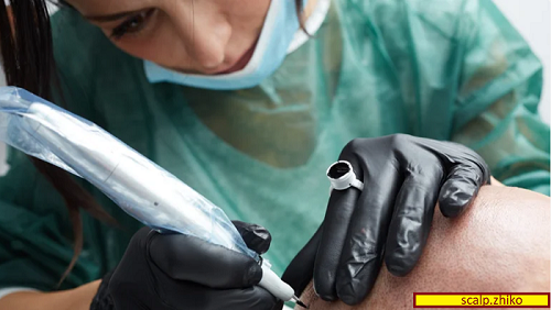 میکرواسکالپ چیست